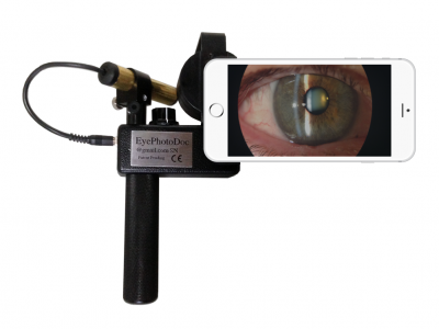 Portable slit lamp for iPhone showing granular dystrophy 