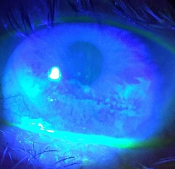 Fluorescein