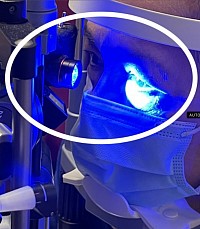 Full field fluorescein LED exciter