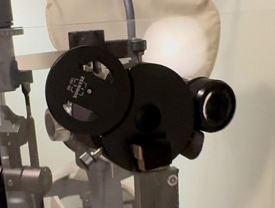 The Ai/documentation iPhone adapter fits almost all slit lamps!